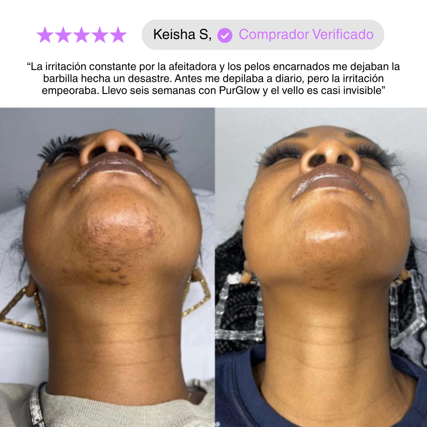 PurGlow™ | Piel Sin Vello