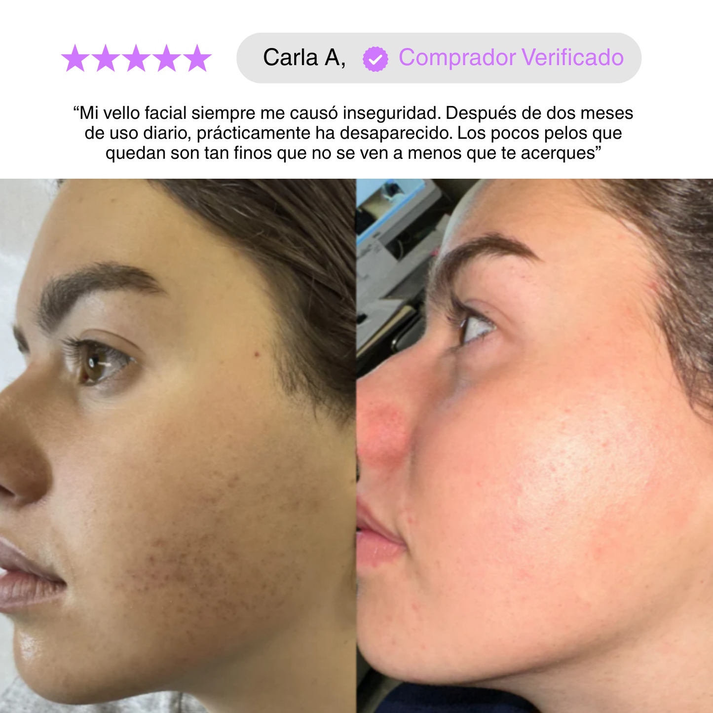 PurGlow™ | Piel Sin Vello