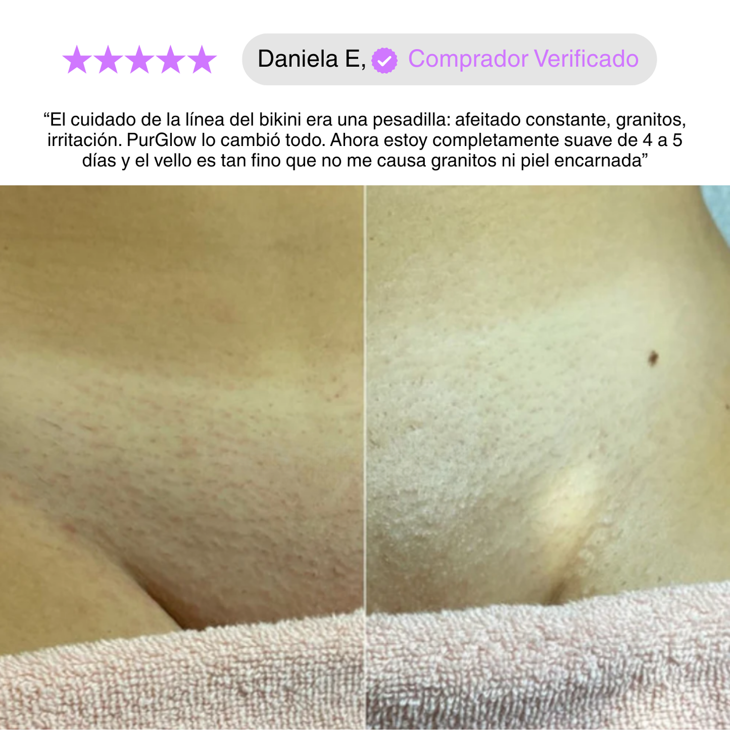 PurGlow™ | Piel Sin Vello