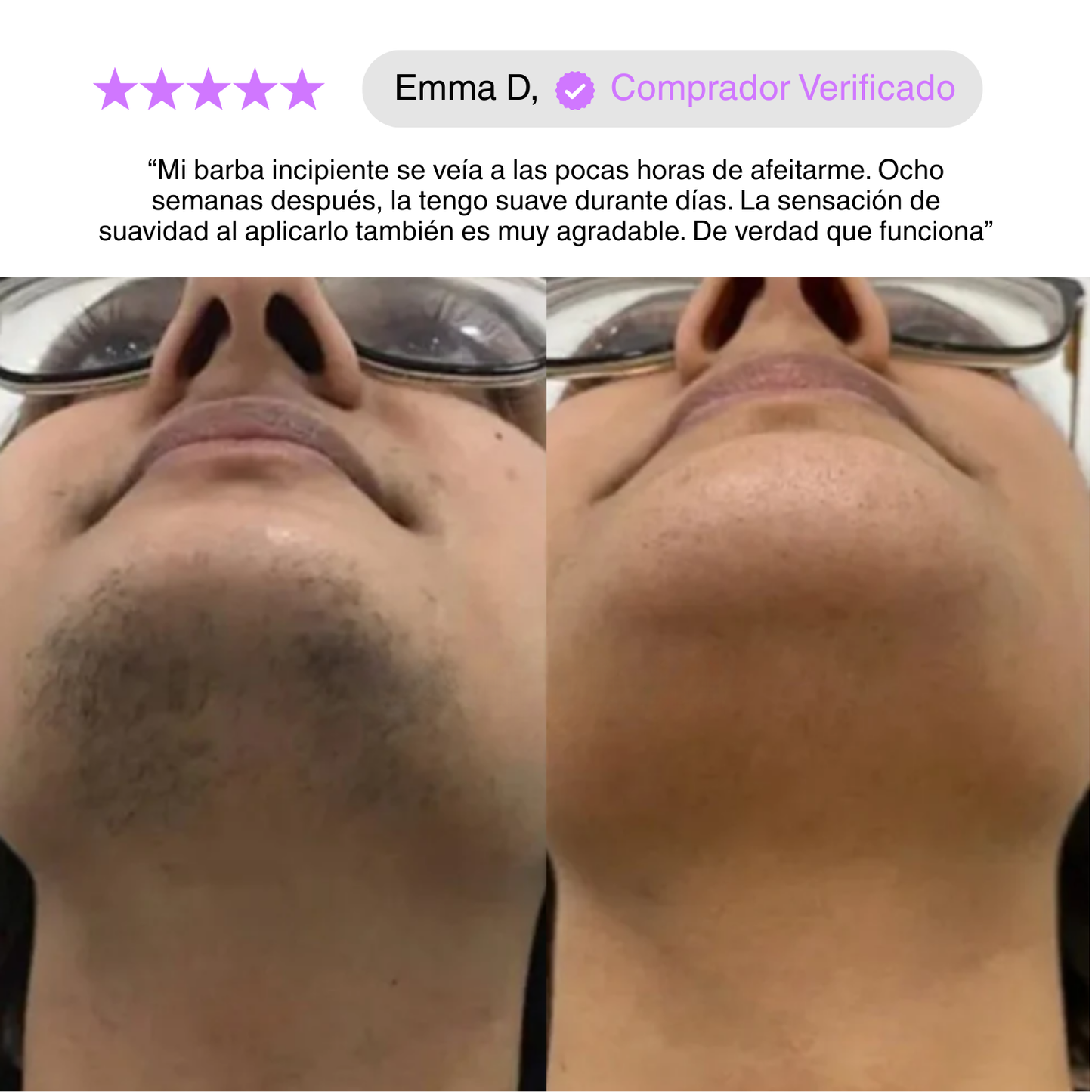 PurGlow™ | Piel Sin Vello